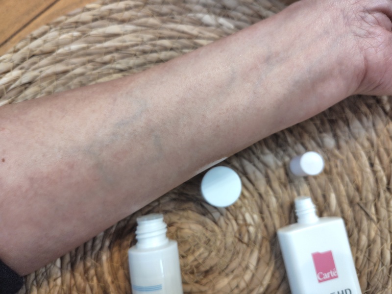 イハダとカルテHDの化粧水なじませた